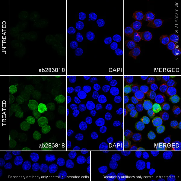 Immunocytochemistry - Anti-IL-1 beta antibody [RM1009] (AB283818)