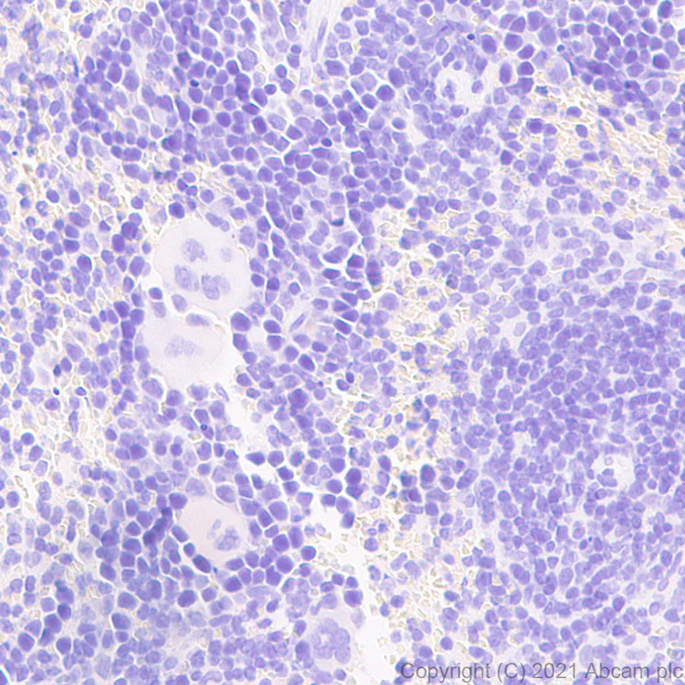 Immunohistochemistry (Formalin/PFA-fixed paraffin-embedded sections) - Anti-IL-1 beta antibody [RM1009] (AB283818)