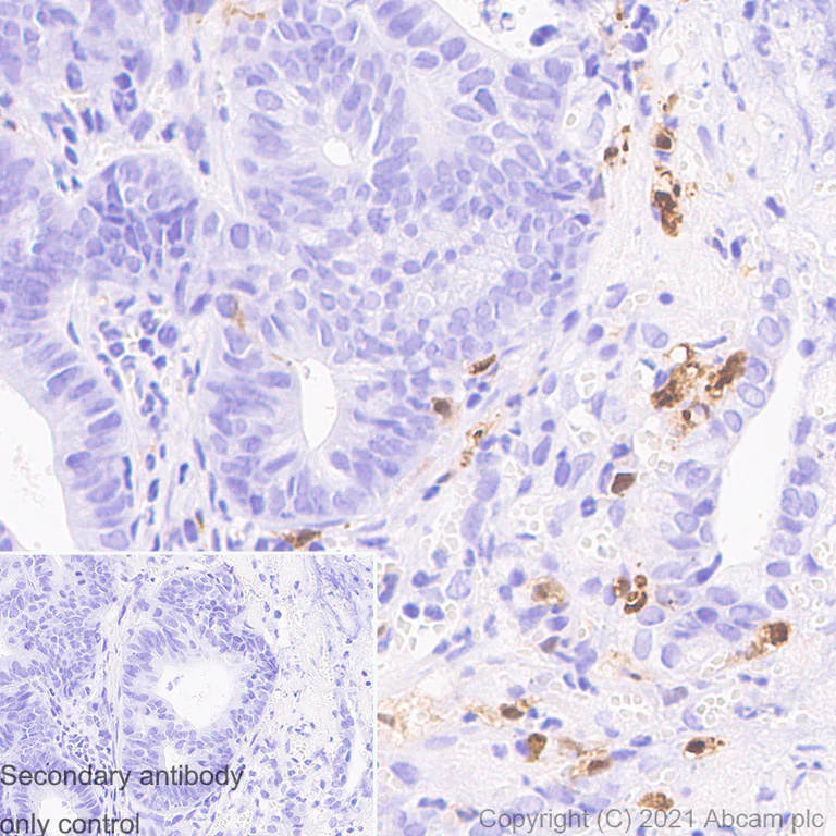 Immunohistochemistry (Formalin/PFA-fixed paraffin-embedded sections) - Anti-IL-1 beta antibody [RM1009] (AB283818)