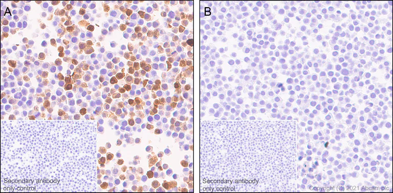 Immunohistochemistry (Formalin/PFA-fixed paraffin-embedded sections) - Anti-IL-1 beta antibody [RM1009] (AB283818)