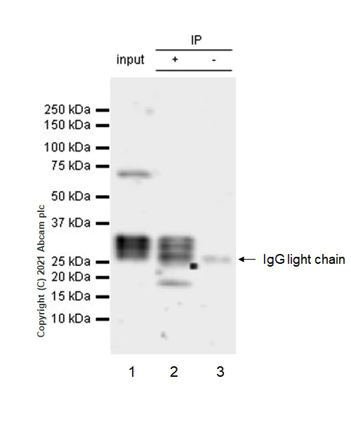Immunoprecipitation - Anti-IL-1 beta antibody [RM1009] (AB283818)