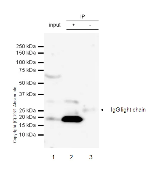 Immunoprecipitation - Anti-IL-1 beta antibody [RM1009] (AB283818)