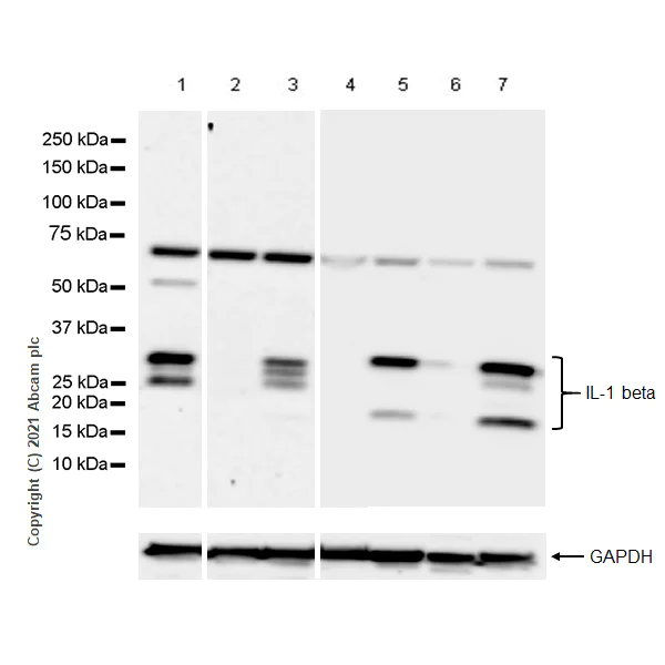 Western blot - Anti-IL-1 beta antibody [RM1009] (AB283818)