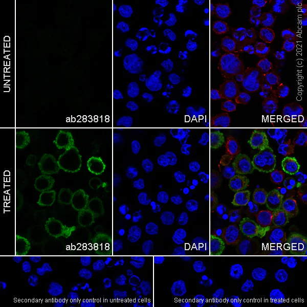 Immunocytochemistry - Anti-IL-1 beta antibody [RM1009] - BSA and Azide free (AB283822)