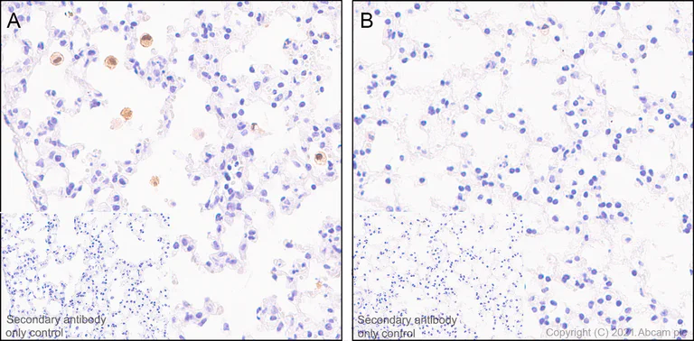 Immunohistochemistry (Formalin/PFA-fixed paraffin-embedded sections) - Anti-IL-1 beta antibody [RM1009] - BSA and Azide free (AB283822)