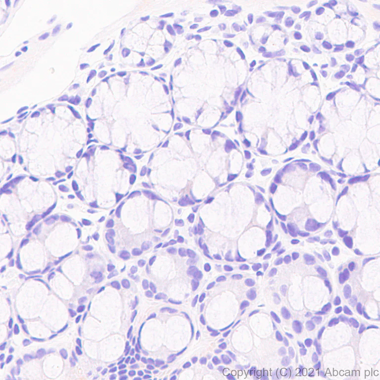 Immunohistochemistry (Formalin/PFA-fixed paraffin-embedded sections) - Anti-IL-1 beta antibody [RM1009] - BSA and Azide free (AB283822)