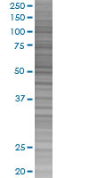 IL-1-R2 overexpression 293T lysate (whole cell)
