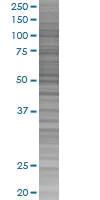 SDS-PAGE - IL-1-R2 overexpression 293T lysate (whole cell) (AB94120)
