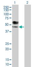 Western blot - IL-1-R2 overexpression 293T lysate (whole cell) (AB94120)