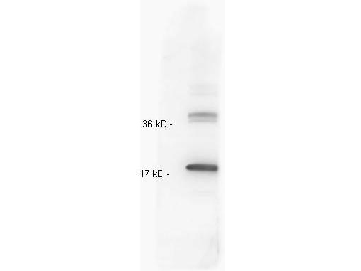 Western blot - Anti-IL-10 antibody (AB34843), expandable thumbnail
