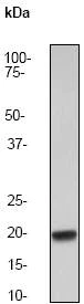 Western blot - Anti-IL-10 antibody [EP1115Y] (AB52909)