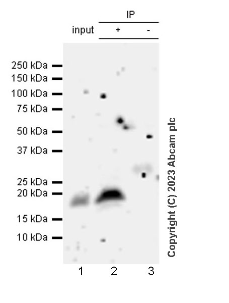 Immunoprecipitation - Anti-IL-10 antibody [EPR27280-88] (AB310329), expandable thumbnail
