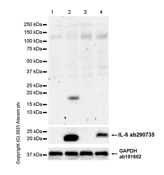 Western blot - Anti-IL-10 antibody [EPR27280-88] (AB310329), expandable thumbnail