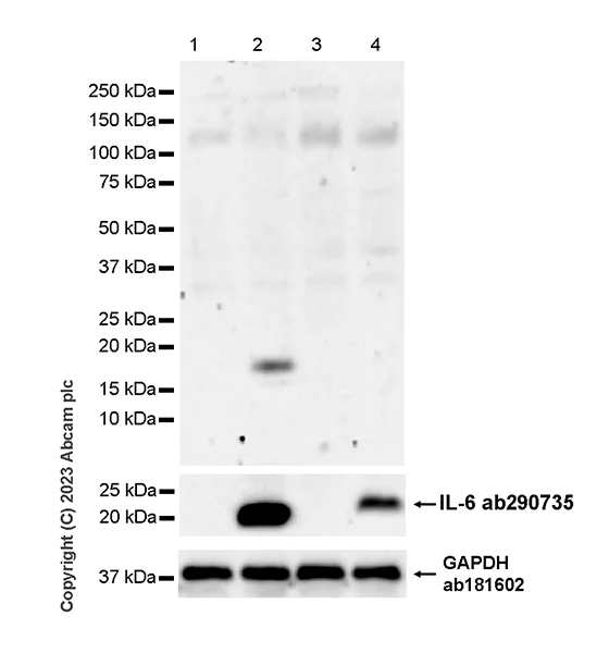 Western blot - Anti-IL-10 antibody [EPR27280-88] - BSA and Azide free (AB310330)