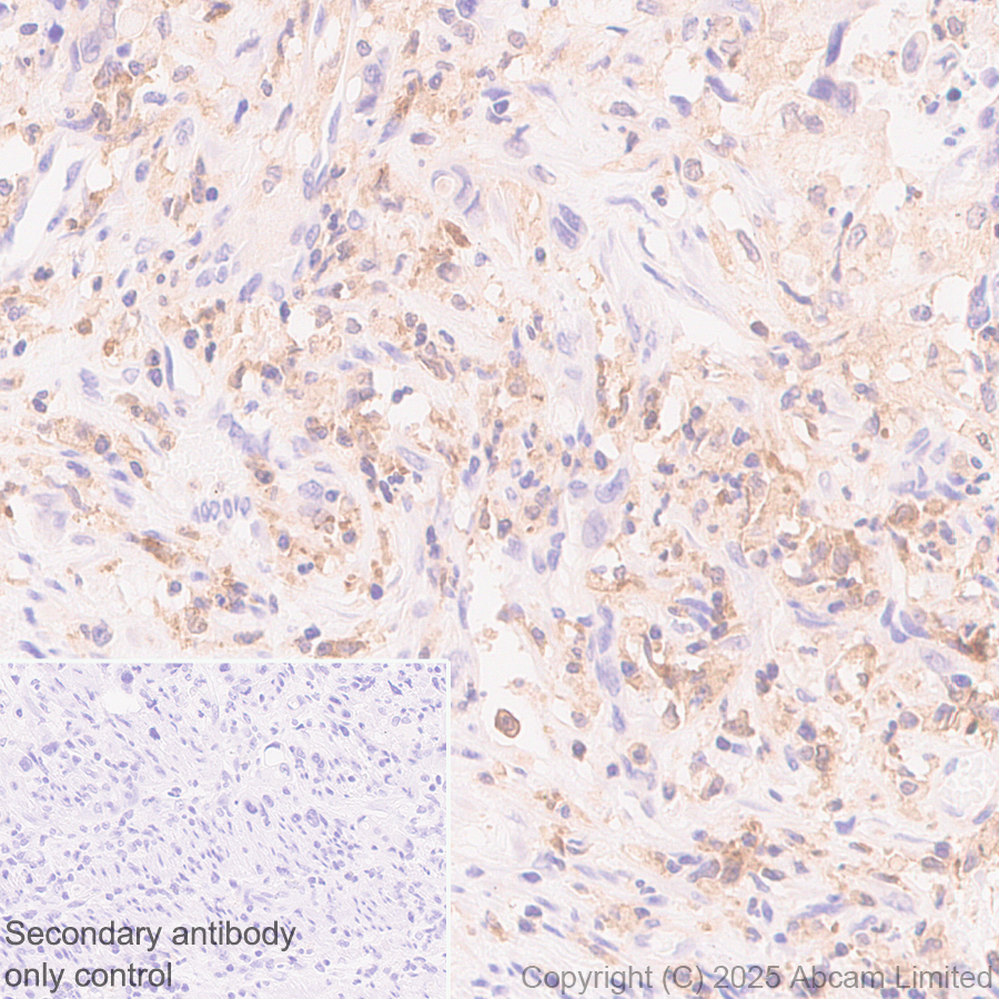 Immunohistochemistry (Formalin/PFA-fixed paraffin-embedded sections) - Anti-IL-10 antibody [EPR28980-513] (AB324012), expandable thumbnail