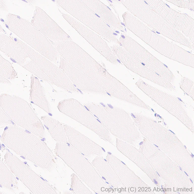 Immunohistochemistry (Formalin/PFA-fixed paraffin-embedded sections) - Anti-IL-10 antibody [EPR28980-513] (AB324012)