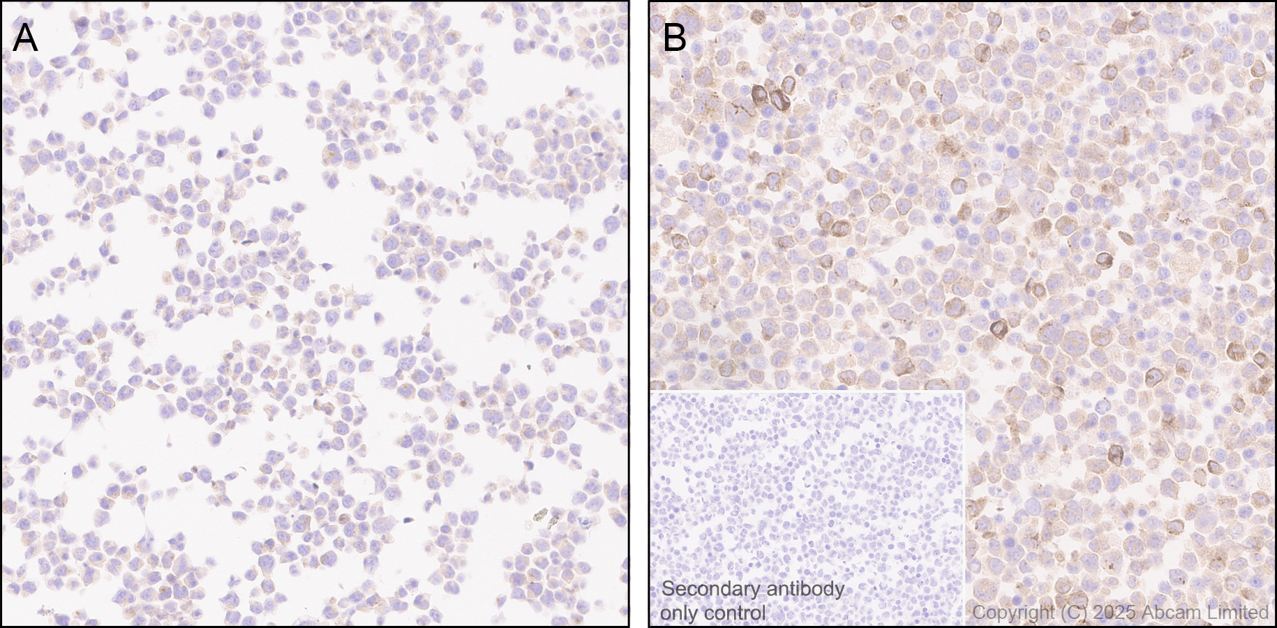Immunohistochemistry (Formalin/PFA-fixed paraffin-embedded sections) - Anti-IL-10 antibody [EPR28980-513] (ab324012), expandable thumbnail