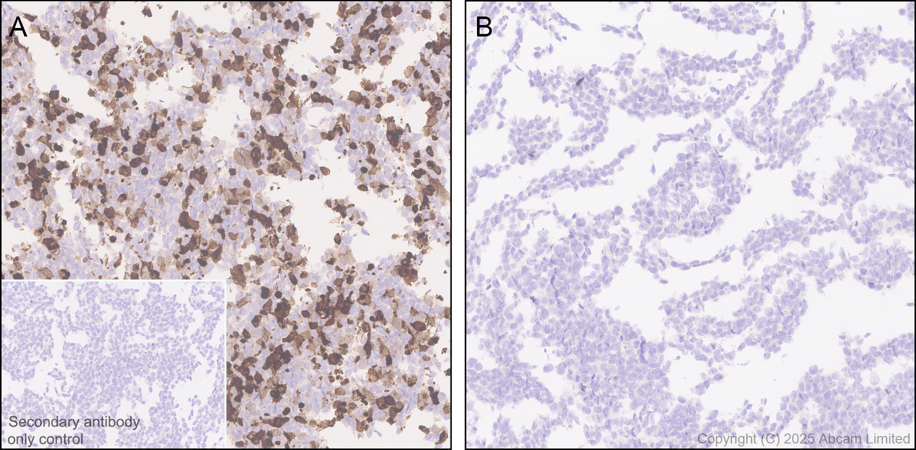 Immunohistochemistry (Formalin/PFA-fixed paraffin-embedded sections) - Anti-IL-10 antibody [EPR28980-513] (ab324012), expandable thumbnail