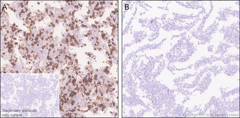 Immunohistochemistry (Formalin/PFA-fixed paraffin-embedded sections) - Anti-IL-10 antibody [EPR28980-513] (AB324012)