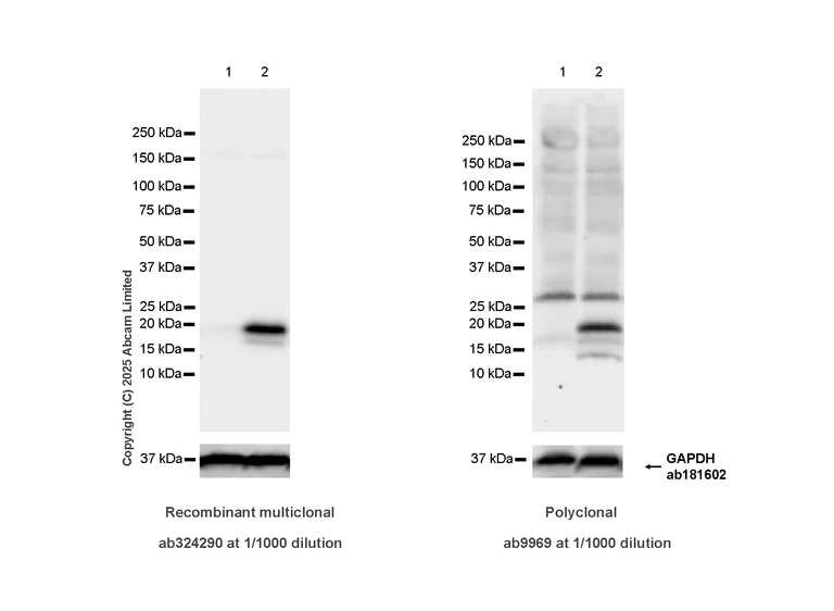 Western blot - Anti-IL-10 antibody [RM1325] (AB324290)