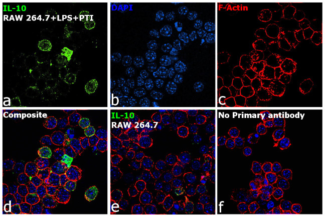Immunocytochemistry/ Immunofluorescence - Anti-IL-10 Antibody [RP23040032] (AB313401), expandable thumbnail