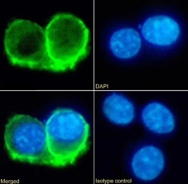 Immunocytochemistry - Anti-IL-10RA antibody [1B1.3a] - Chimeric (AB281916)
