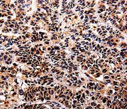 Immunohistochemistry (Formalin/PFA-fixed paraffin-embedded sections) - Anti-IL-10RA antibody (AB197666)