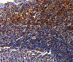Immunohistochemistry (Formalin/PFA-fixed paraffin-embedded sections) - Anti-IL-10RA antibody (AB197666)