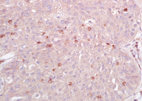 Immunohistochemistry (Formalin/PFA-fixed paraffin-embedded sections) - Anti-IL-10RA antibody (AB225530)