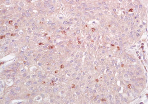 Immunohistochemistry (Formalin/PFA-fixed paraffin-embedded sections) - Anti-IL-10RA antibody (AB225530)