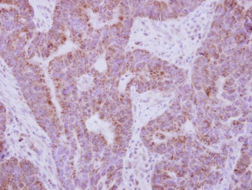 Immunohistochemistry (Formalin/PFA-fixed paraffin-embedded sections) - Anti-IL-10RA antibody (AB228010), expandable thumbnail