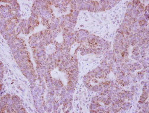 Immunohistochemistry (Formalin/PFA-fixed paraffin-embedded sections) - Anti-IL-10RA antibody (AB228010)