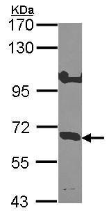 Western blot - Anti-IL-10RA antibody (AB228010), expandable thumbnail