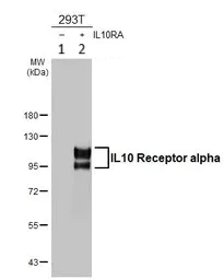 Western blot - Anti-IL-10RA antibody (AB228010)