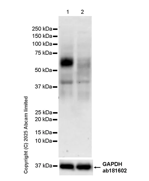 Western blot - Anti-IL-10RB/IL-10R2 antibody [EPR28963-63] (AB325237)