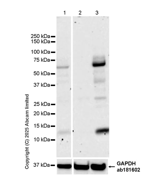 Western blot - Anti-IL-10RB/IL-10R2 antibody [EPR28963-63] (AB325237)