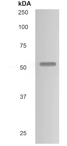 Western blot - Anti-IL-10RB/IL-10R2 antibody [MM0360-8R24] (AB89884)