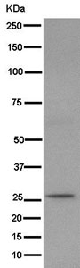 Western blot - Anti-IL-11 antibody [EPR15253] - BSA and Azide free (AB245773)