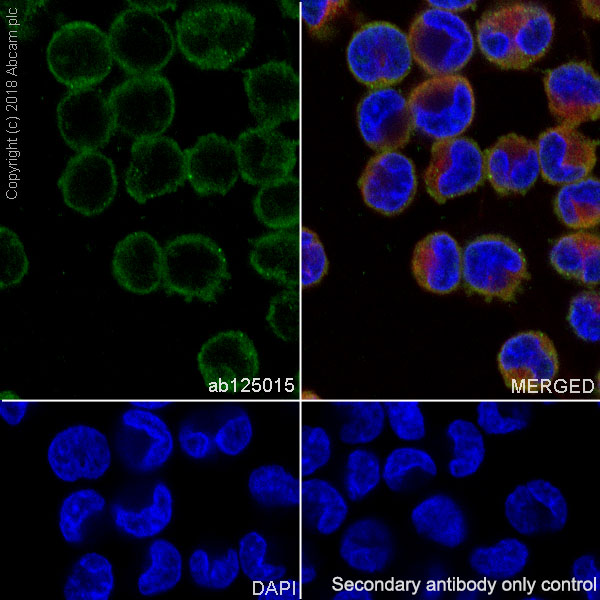 Immunocytochemistry/ Immunofluorescence - Anti-IL-11RA antibody [EPR5446] (AB125015), expandable thumbnail