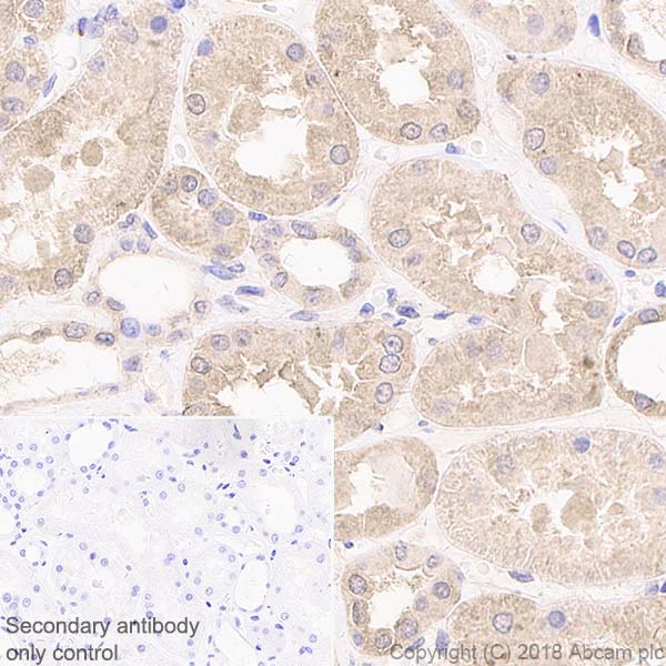 Immunohistochemistry (Formalin/PFA-fixed paraffin-embedded sections) - Anti-IL-11RA antibody [EPR5446] (AB125015), expandable thumbnail