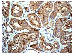 Immunohistochemistry (Formalin/PFA-fixed paraffin-embedded sections) - Anti-IL-11RA antibody [EPR5446] (ab125015), expandable thumbnail