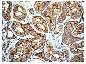 Immunohistochemistry (Formalin/PFA-fixed paraffin-embedded sections) - Anti-IL-11RA antibody [EPR5446] (AB125015)