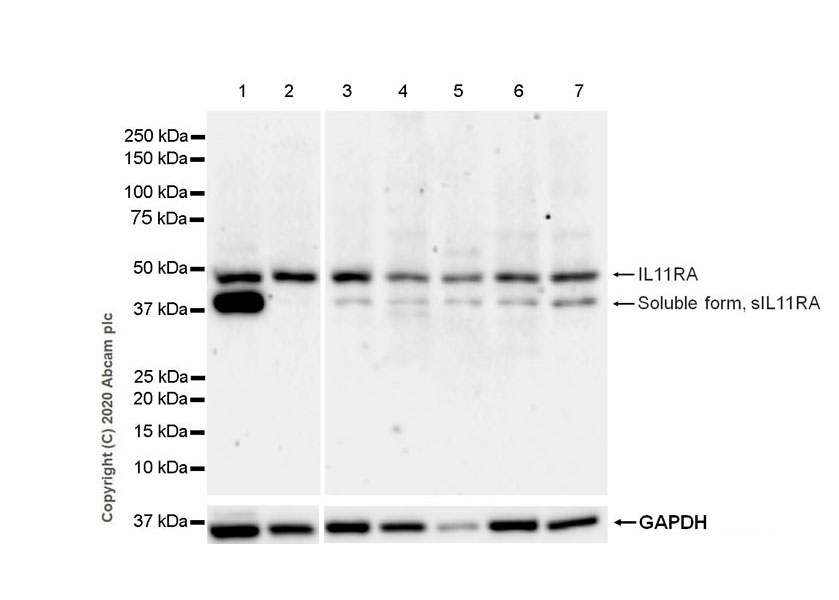 Western blot - Anti-IL-11RA antibody [EPR5446] (AB125015), expandable thumbnail