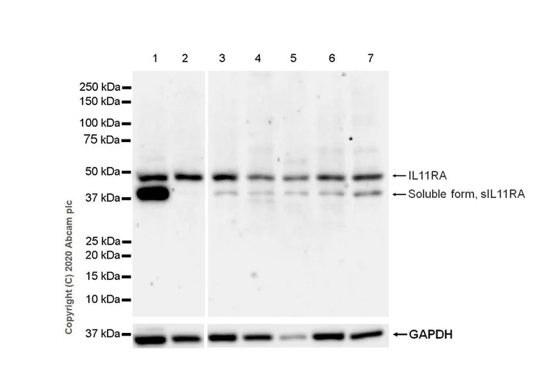 Western blot - Anti-IL-11RA antibody [EPR5446] (AB125015)