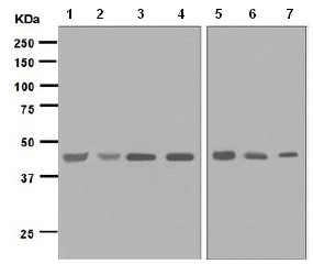 Western blot - Anti-IL-11RA antibody [EPR5446] (ab125015), expandable thumbnail