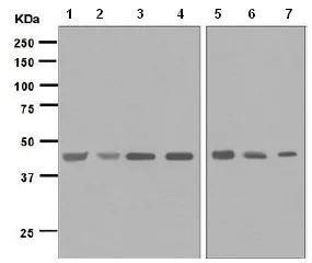 Western blot - Anti-IL-11RA antibody [EPR5446] (AB125015)