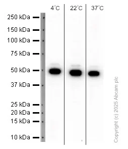 Western blot - Anti-IL-11RA antibody [EPR5446] (AB125015)