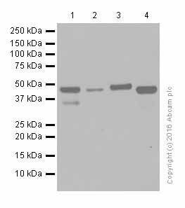 Western blot - Anti-IL-11RA antibody [EPR5446] (AB125015), expandable thumbnail