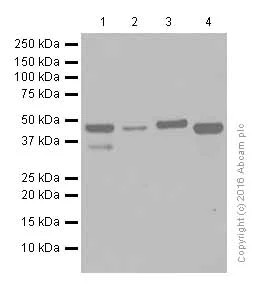 Western blot - Anti-IL-11RA antibody [EPR5446] (AB125015)