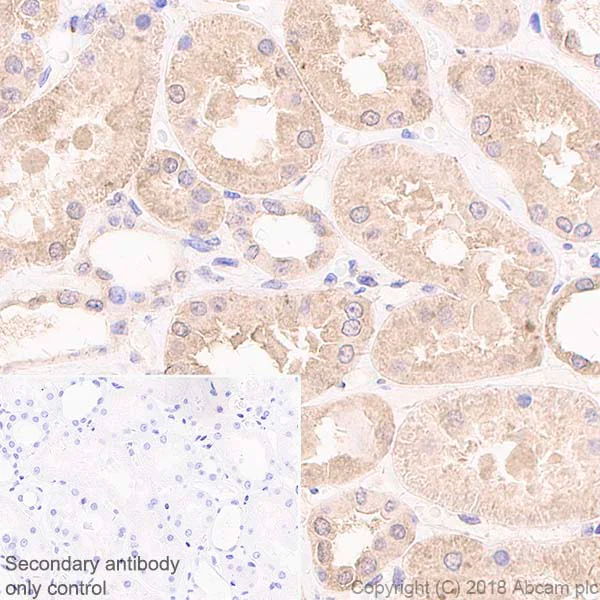 Immunohistochemistry (Formalin/PFA-fixed paraffin-embedded sections) - Anti-IL-11RA antibody [EPR5446] - BSA and Azide free (AB240950)